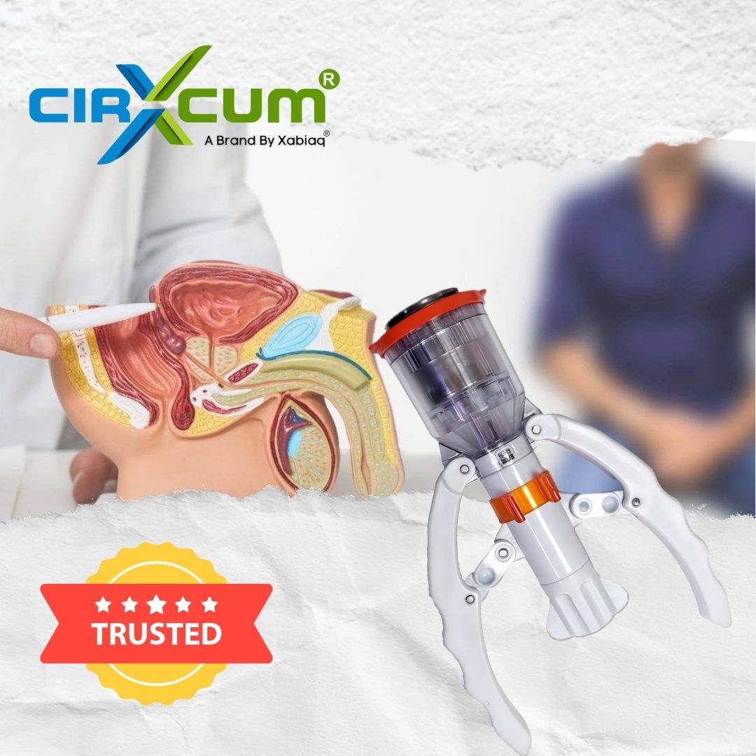 How Xabiaq Techno Medical Became a Trusted Circumcision Stapler Kit Suppliers in India.